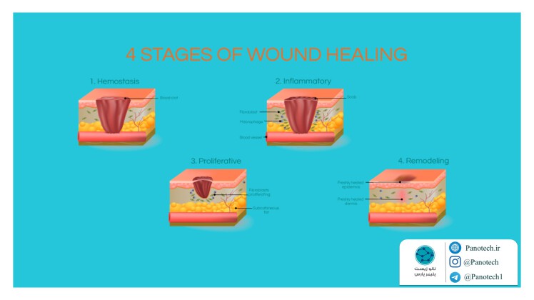 چهار مرحله اصلی در ترمیم زخم؛