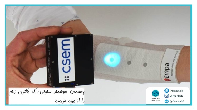 توسط محققان شرکت Empa سوییس ساخته شد : پانسمان هوشمند سلولزی که باکتری زخم را از بین می‌برد.