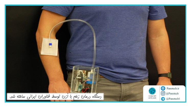 دستگاه درمان زخم با اُزن توسط فناور ایرانی ساخته شد.